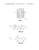 SURFACE TREATMENT OF A POLYMERIC STENT diagram and image