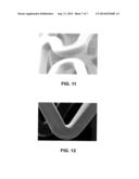 SURFACE TREATMENT OF A POLYMERIC STENT diagram and image