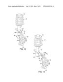 VEHICLE FRONT SUSPENSION diagram and image