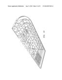 Flexible Ergonomic Sportsboard Wedges diagram and image