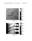 INHERENTLY RADIOPAQUE POLYMERIC PRODUCTS FOR EMBOLOTHERAPY diagram and image