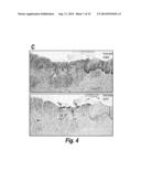 METHODS AND REAGENTS FOR DETECTION AND TREATMENT OF ESOPHAGEAL METAPLASIA diagram and image