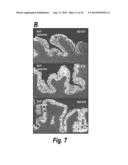 METHODS AND REAGENTS FOR DETECTION AND TREATMENT OF ESOPHAGEAL METAPLASIA diagram and image