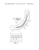 Forming Composite Features Using Steered Discontinuous Fiber Pre-Preg diagram and image