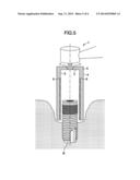 DEVICE FOR TREATING PERI-IMPLANTITIS diagram and image