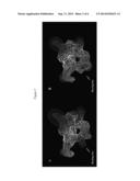 Relaxin Proteins For Use In The Diagnosis, Prevention or Treatment of     Multiple Sclerosis diagram and image