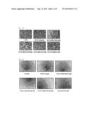 Novel Compound Having Angiogenesis Inhibitory Activity, Method for     Preparing Same, and Pharmaceutical Composition Comprising Same diagram and image