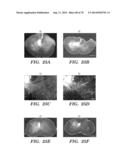 CO-ACTIVATION OF MTOR AND STAT3 PATHWAYS TO PROMOTE NEURONAL SURVIVAL AND     REGENERATION diagram and image