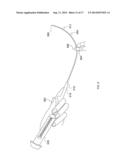INCONTINENCE SLING, DELIVERY DEVICE AND METHOD OF USE diagram and image