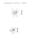 IMPLANTABLE MEDICAL DEVICE AND METHODS OF DELIVERING THE IMPLANTABLE     MEDICAL DEVICE diagram and image