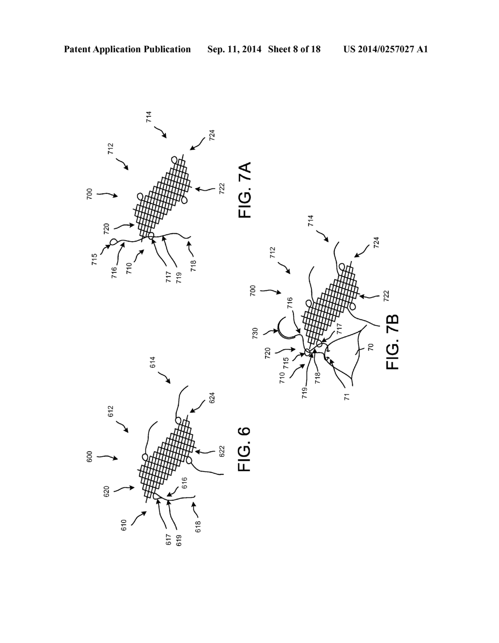 IMPLANTABLE MEDICAL DEVICE AND METHODS OF DELIVERING THE IMPLANTABLE     MEDICAL DEVICE - diagram, schematic, and image 09