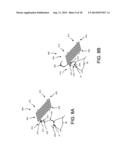 IMPLANTABLE MEDICAL DEVICE AND METHODS OF DELIVERING THE IMPLANTABLE     MEDICAL DEVICE diagram and image