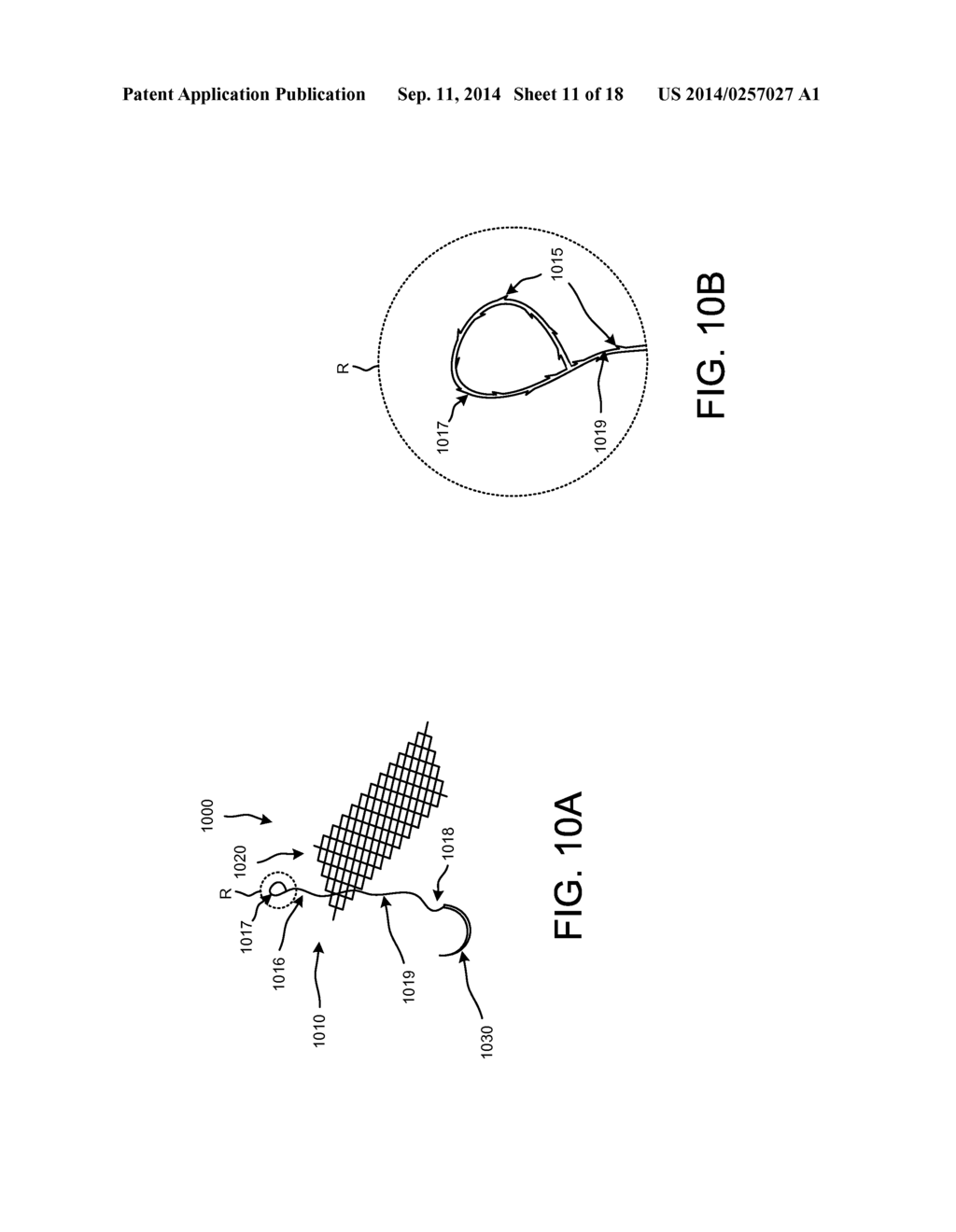 IMPLANTABLE MEDICAL DEVICE AND METHODS OF DELIVERING THE IMPLANTABLE     MEDICAL DEVICE - diagram, schematic, and image 12