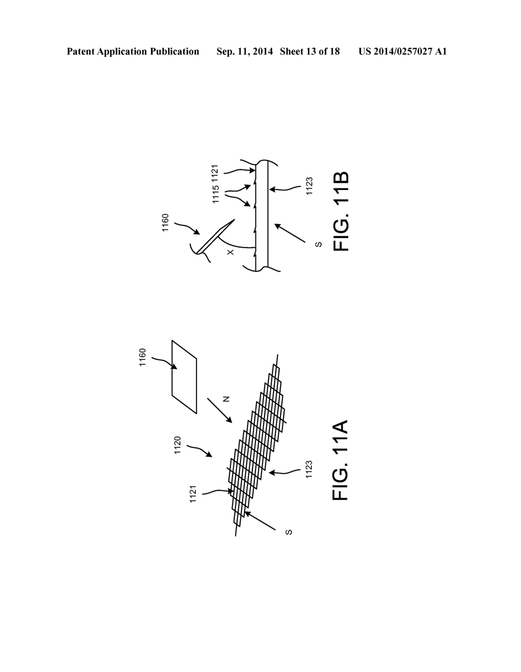 IMPLANTABLE MEDICAL DEVICE AND METHODS OF DELIVERING THE IMPLANTABLE     MEDICAL DEVICE - diagram, schematic, and image 14