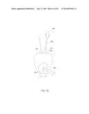 MEDICAL DEVICE AND METHOD FOR INJECTING A FLUID diagram and image