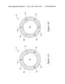 CATHETER HAVING ELECTRICALLY CONDUCTIVE PATHWAYS diagram and image