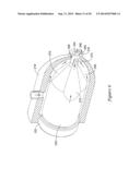 CATHETER HAVING ELECTRICALLY CONDUCTIVE PATHWAYS diagram and image