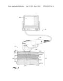 DEVICES AND METHODS FOR MULTI-FOCUS ULTRASOUND THERAPY diagram and image