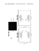 DEVICES AND METHODS FOR MULTI-FOCUS ULTRASOUND THERAPY diagram and image