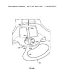 Multi-function surgical instrument tool actuator assembly diagram and image