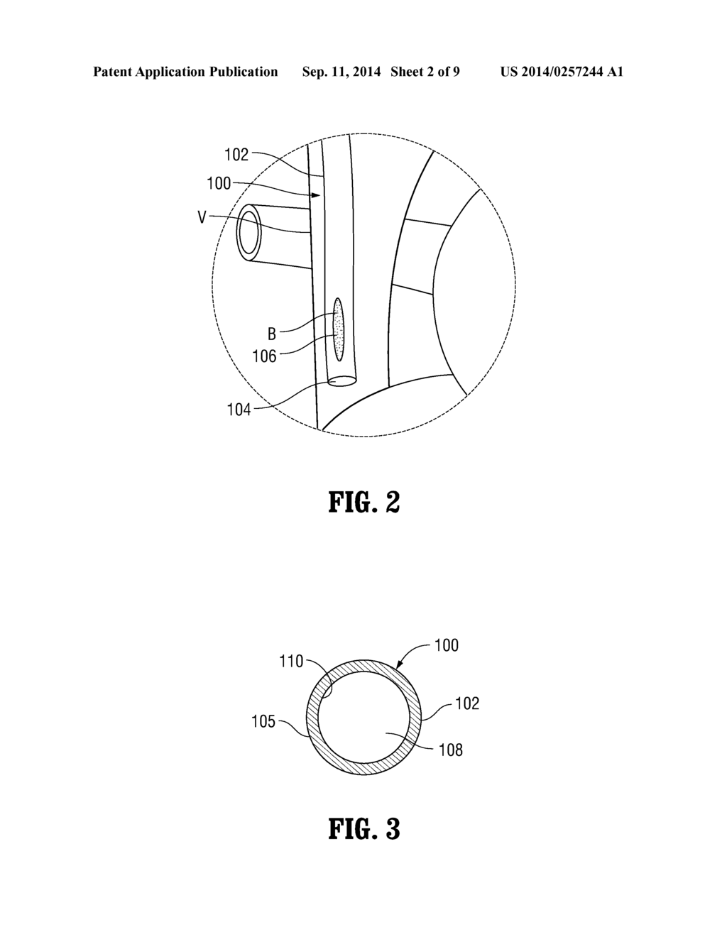 FLUSHING STYLET - diagram, schematic, and image 03