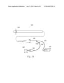 Irrigated ablation catheter system with pulsatile flow to prevent thrombus diagram and image