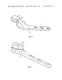 QUADRUPED STIFLE STABILIZATION SYSTEM diagram and image