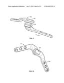 QUADRUPED STIFLE STABILIZATION SYSTEM diagram and image