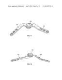 QUADRUPED STIFLE STABILIZATION SYSTEM diagram and image