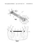 IMPROVEMENTS IN AND RELATING TO IMPLANTS diagram and image