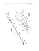 IMPROVEMENTS IN AND RELATING TO IMPLANTS diagram and image