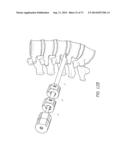 METHOD AND APPARATUS FOR MINIMALLY INVASIVE INSERTION OF INTERVERTEBRAL     IMPLANTS diagram and image