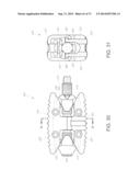 METHOD AND APPARATUS FOR MINIMALLY INVASIVE INSERTION OF INTERVERTEBRAL     IMPLANTS diagram and image