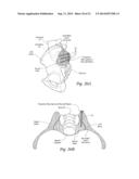 SYSTEMS AND METHODS FOR THE FUSION OF THE SACRAL-ILIAC JOINT diagram and image