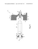 POLYMER 4-IN-2 FEMORAL CUTTING INSTRUMENT HAVING SEPARABLE A/P AND CHAMFER     CUTTING BLOCKS diagram and image