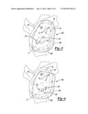 Patient-Specific Glenoid Guide With a Reusable Guide Holder diagram and image