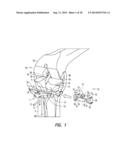 TIBIAL RESECTION SYSTEMS AND METHODS FOR CRUCIATE LIGAMENT RETAINMENT diagram and image