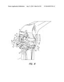 TIBIAL RESECTION SYSTEMS AND METHODS FOR CRUCIATE LIGAMENT RETAINMENT diagram and image