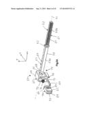 VERTEBRAL MANIPULATION ASSEMBLY diagram and image