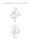 Methods and Apparatus for Insertion of Implant Material diagram and image