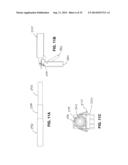 Methods and Apparatus for Insertion of Implant Material diagram and image