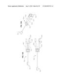 Methods and Apparatus for Insertion of Implant Material diagram and image