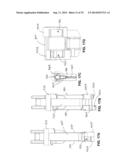 Methods and Apparatus for Insertion of Implant Material diagram and image