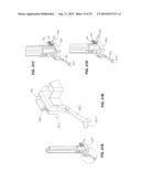 Methods and Apparatus for Insertion of Implant Material diagram and image