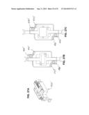 Methods and Apparatus for Insertion of Implant Material diagram and image