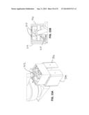 Methods and Apparatus for Insertion of Implant Material diagram and image