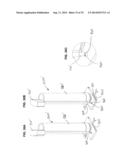 Methods and Apparatus for Insertion of Implant Material diagram and image