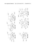 Methods and Apparatus for Insertion of Implant Material diagram and image