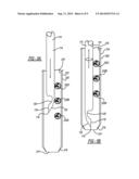 Method And Apparatus To Reload Suture Anchors diagram and image