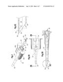 ATRAUMATIC IOL INSERTION CARTRIDGE OPENING diagram and image